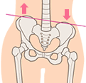 骨盤が左右どちらかに傾くと…下半身に脂肪が付く